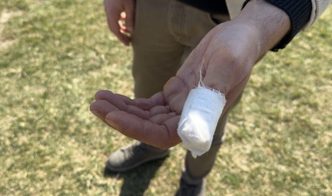 Karabük’te pitbull saldırısına uğrayan Yalçın Açıkgöz ve köpeği yaralandı. Olay,